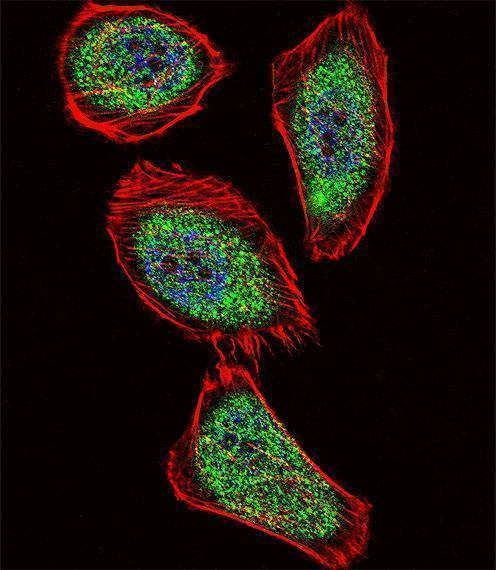Anti-IPF (C-term) Antibody