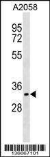 Anti-CDK5R1 (p35) (C-term) Antibody