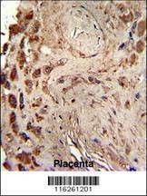 Anti-PRKRA (S246) Antibody