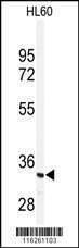 Anti-PRKRA (S246) Antibody
