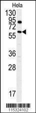 Anti-ANTXR1 (Y382) Antibody