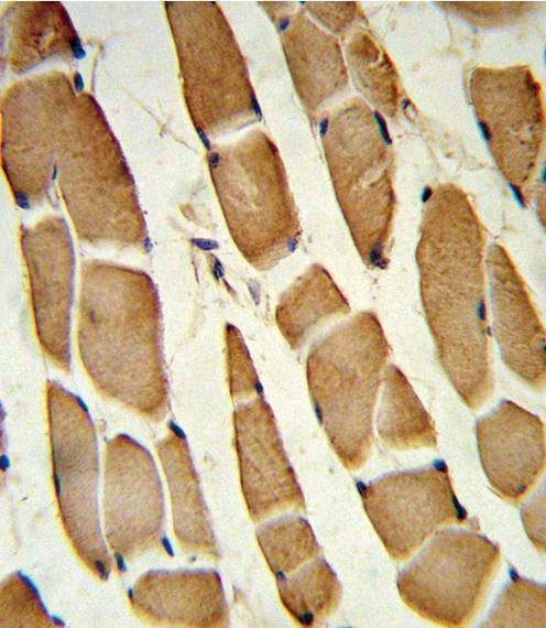 Anti-SMAD4 (C-term) Antibody