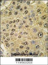 Anti-HIF1Alpha (C-term) Antibody