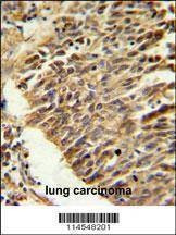 Anti-HIF1Alpha (Center) Antibody