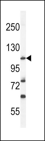 Anti-HIF1Alpha (Center) Antibody