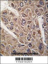 Anti-BICD2 (C-term) Antibody
