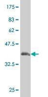 Anti-JAG1 Antibody