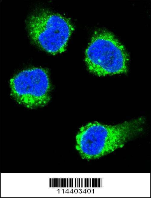 Anti-NGFB (Center) Antibody