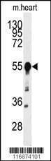 Anti-BACE1 (N-term) Antibody