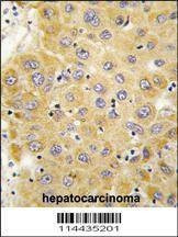 Anti-CTGF (C-term) Antibody