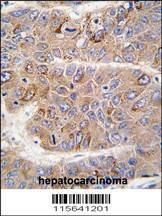 Anti-IRS2 (C-term) Antibody