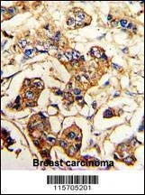 Anti-ACTN4 (C-term) Antibody