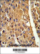 Anti-CYP3A5 (Center) Antibody