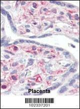 Anti-IRAK (C-term) Antibody