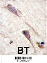 Anti-B-RAF (S602) Antibody