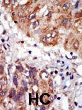Anti-LIM Kinase 1 (LIMK1) (N-term) Antibody