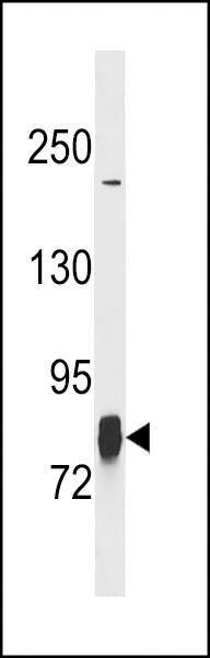 Anti-LIM Kinase 1 (LIMK1) (N-term) Antibody