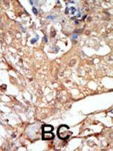 Anti-RAF1 (N-term) Antibody