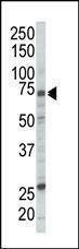 Anti-RAF1 (N-term) Antibody
