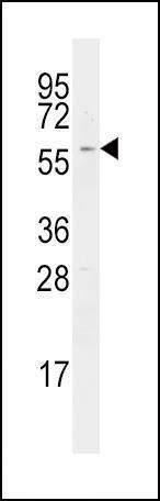 Anti-RIPK2 (C-term) Antibody