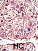 Anti-TGF Beta Receptor I (Center) Antibody