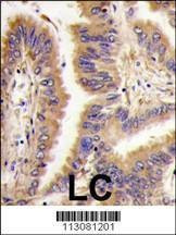 Anti-Transglutaminase (TGM2) (Center K444) Antibody