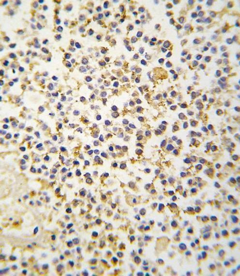 Anti-ALDH1A3 (N-term) Antibody
