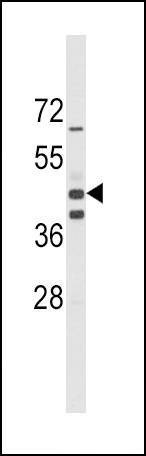 Anti-ALDH1A3 (Center) Antibody