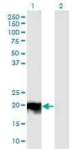 Anti-JDP2 Antibody