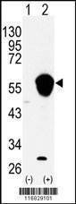 Anti-ALDH3A1 (N-term) Antibody