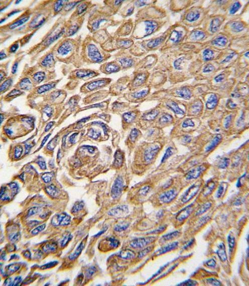 Anti-ALDH3A1 (Center) Antibody