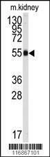Anti-ALDH9A1 (C-term) Antibody