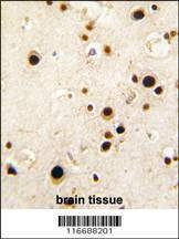 Anti-HNRPQ (C-term) Antibody