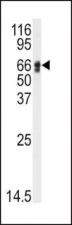 Anti-AGT (N-term) Antibody