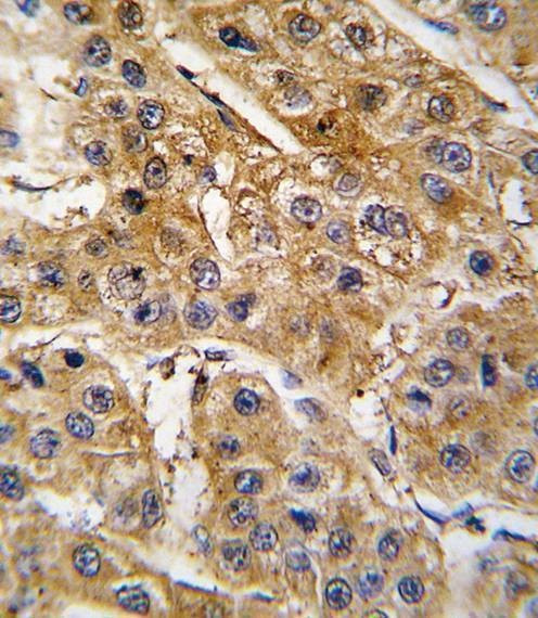 Anti-AGT (N-term) Antibody