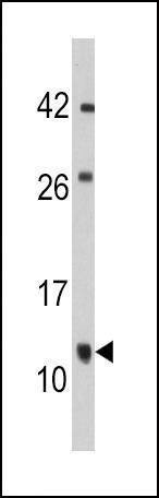 Anti-FKBP1B (N-term E6) Antibody