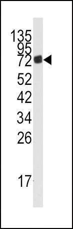 Anti-AMPD3 (Center) Antibody