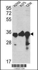 Anti-GAPDH (N-term) Antibody