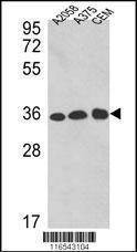 Anti-GAPDH (C-term R248) Antibody
