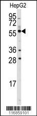 Anti-ALDH4A1 (C-term) Antibody