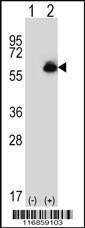 Anti-ALDH4A1 (C-term) Antibody