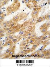 Anti-ALDH4A1 (C-term) Antibody