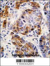 Anti-ALDH4A1 (Center) Antibody