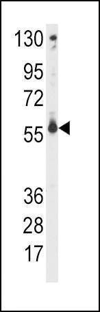 Anti-CYP2C9 (Center) Antibody