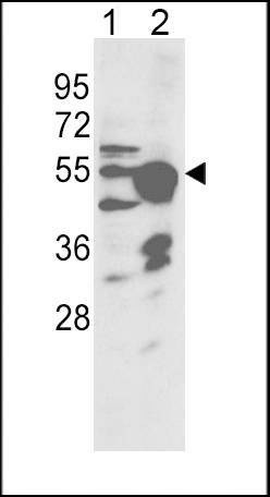 Anti-CYP2R1 (Center) Antibody