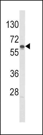 Anti-GCK (C-term) Antibody