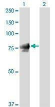 Anti-JUP Antibody