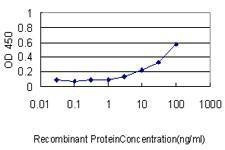 Anti-JUP Antibody