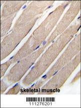 Anti-MEKK4 (MAP2K4) (S257) Antibody