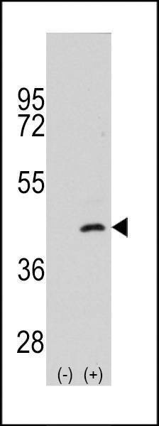 Anti-MEKK4 (MAP2K4) (S257) Antibody